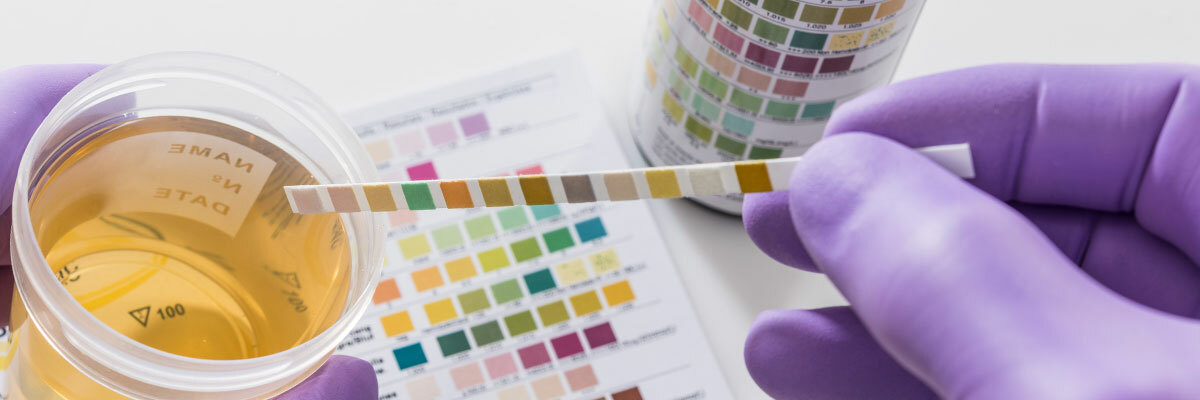 urinalysis test for pre-employment drug test
