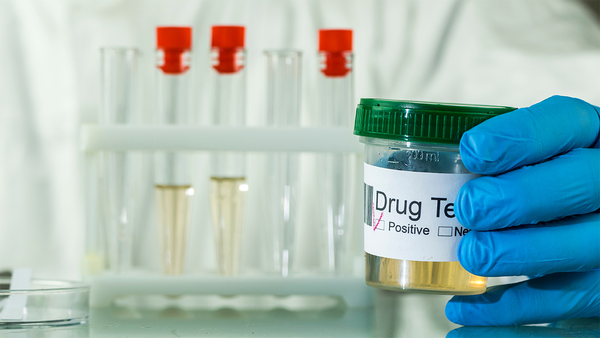 urine analysis drug testing