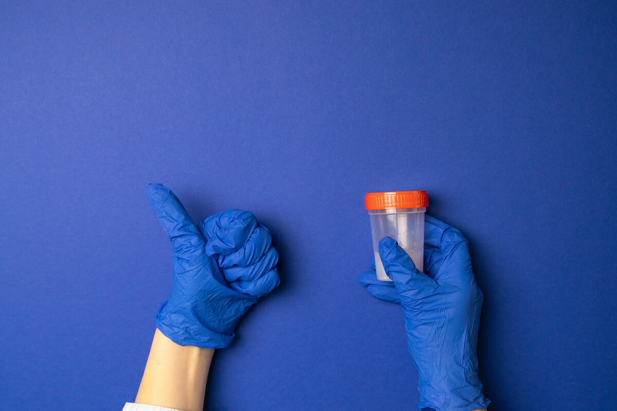 gloved hands with thumbs up and urine sample