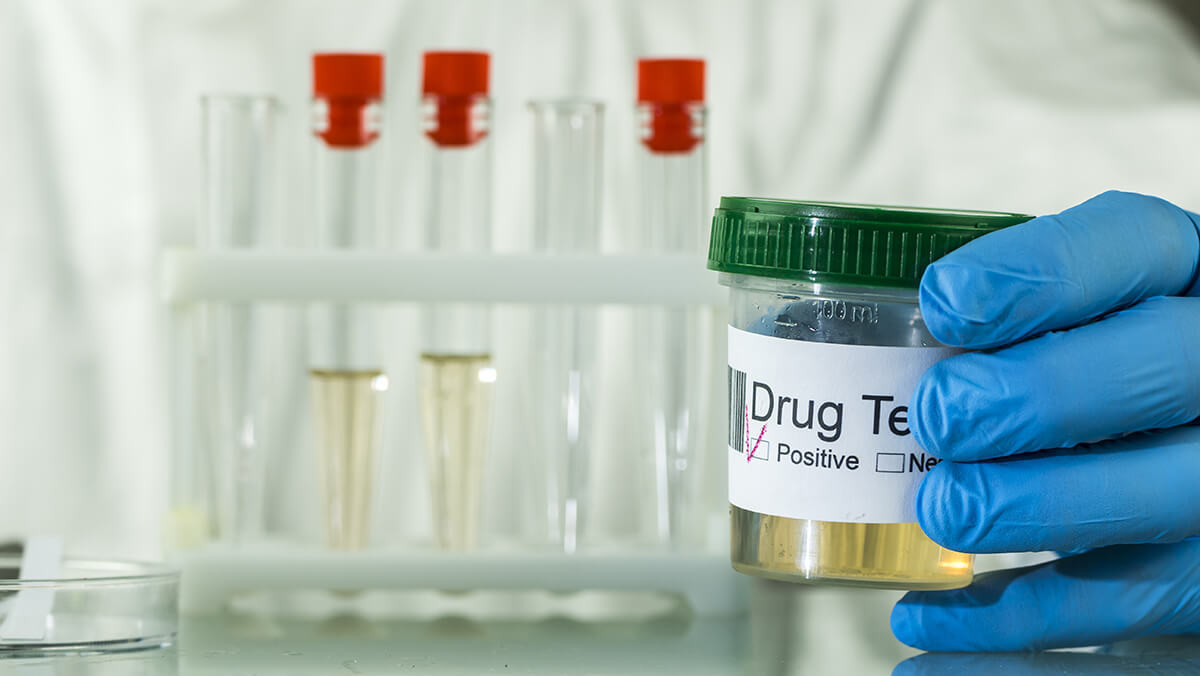 positive urine drug test