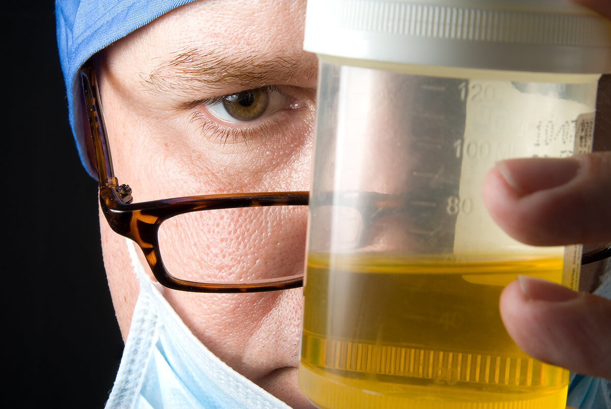 doctor examining a urine specimen closely
